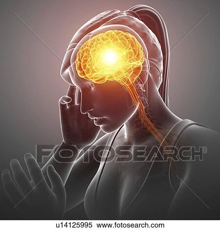 Woman with headache, computer illustration. View Large Photo Image Stock Photography - Woman with headache, computer illustration.. Fotosearch