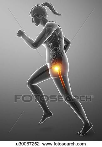 Stock Image - Woman with hip pain, computer illustration.. Fotosearch