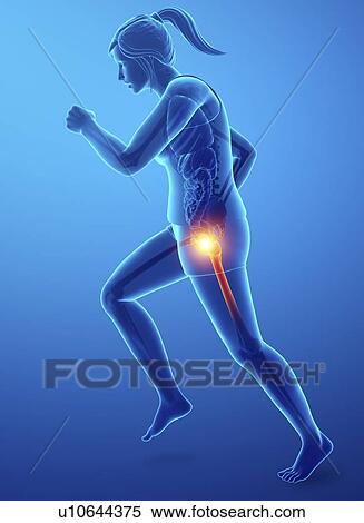 Stock Photography - Woman with hip pain, computer illustration.. Fotosearch