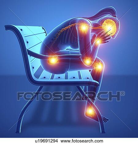 Woman with joint pain, computer illustration. View Large Photo Image Picture - Woman with joint pain, computer illustration.. Fotosearch