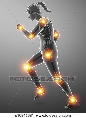Stock Image - Woman with joint pain, computer illustration.. Fotosearch