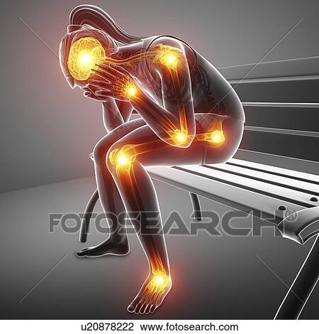Woman with joint pain, computer illustration. View Large Photo Image Stock Image - Woman with joint pain, computer illustration.. Fotosearch