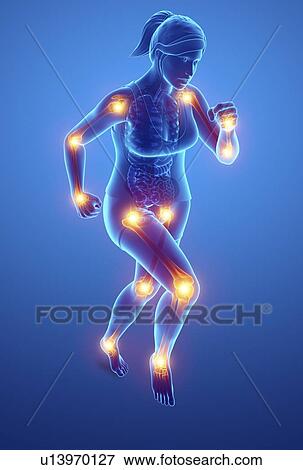 Woman with joint pain, computer illustration. View Large Photo Image Stock Photo - Woman with joint pain, computer illustration.. Fotosearch