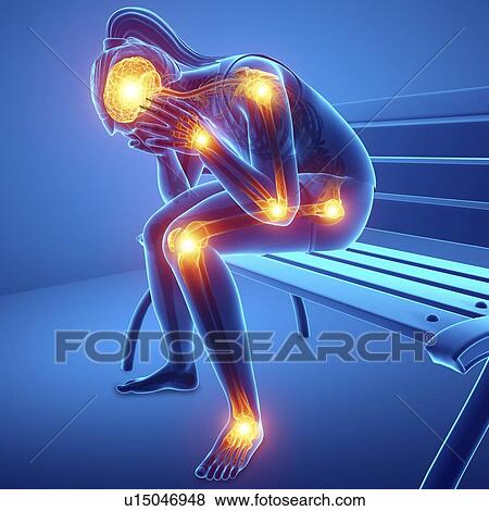 Stock Photo - Woman with joint pain, computer illustration.. Fotosearch