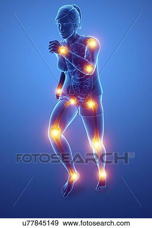 Woman with joint pain, computer illustration. View Large Photo Image Stock Photo - Woman with joint pain, computer illustration.. Fotosearch