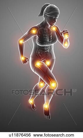 Stock Photograph - Woman with joint pain, computer illustration.. Fotosearch