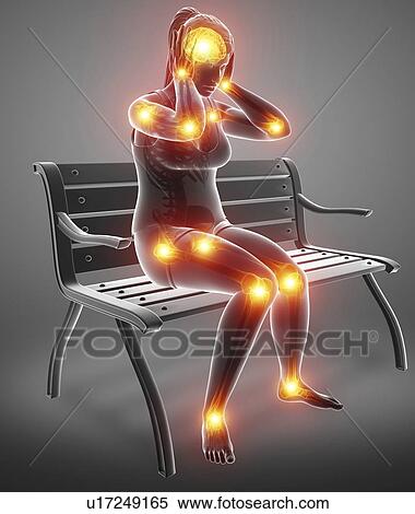 Stock Photography - Woman with joint pain, computer illustration.. Fotosearch