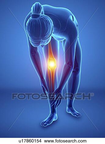 Woman with knee pain, computer illustration. View Large Photo Image Picture - Woman with knee pain, computer illustration.. Fotosearch