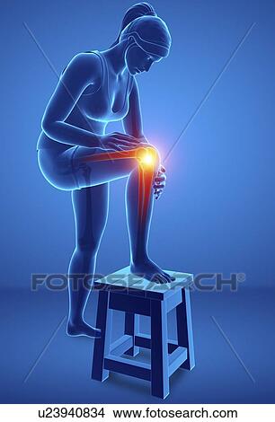 Picture - Woman with knee pain, computer illustration.. Fotosearch
