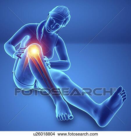 Picture - Woman with knee pain, computer illustration.. Fotosearch