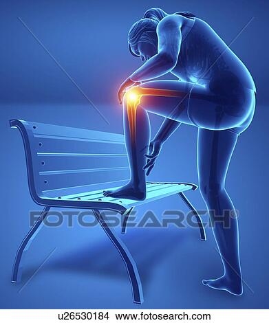 Woman with knee pain, computer illustration. View Large Photo Image Picture - Woman with knee pain, computer illustration.. Fotosearch