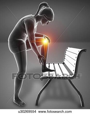 Picture - Woman with knee pain, computer illustration.. Fotosearch
