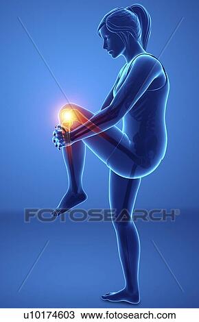 Stock Image - Woman with knee pain, computer illustration.. Fotosearch