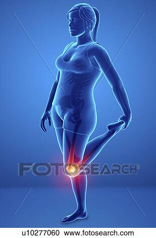 Stock Image - Woman with knee pain, computer illustration.. Fotosearch