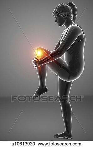 Stock Image - Woman with knee pain, computer illustration.. Fotosearch