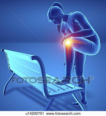 Stock Image - Woman with knee pain, computer illustration.. Fotosearch