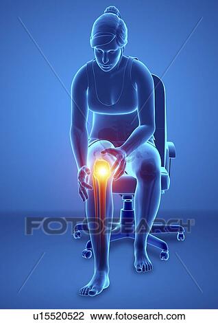 Stock Image - Woman with knee pain, computer illustration.. Fotosearch