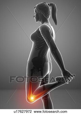 Stock Image - Woman with knee pain, computer illustration.. Fotosearch