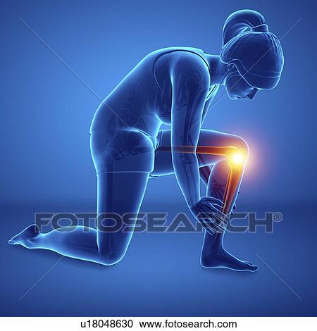 Stock Image - Woman with knee pain, computer illustration.. Fotosearch