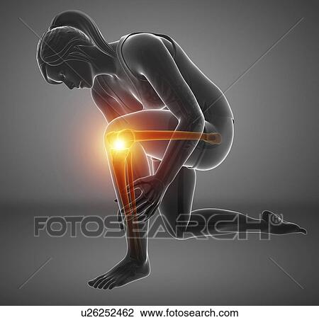 Stock Image - Woman with knee pain, computer illustration.. Fotosearch
