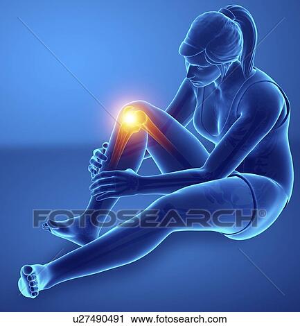Stock Image - Woman with knee pain, computer illustration.. Fotosearch
