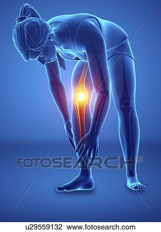 Stock Image - Woman with knee pain, computer illustration.. Fotosearch