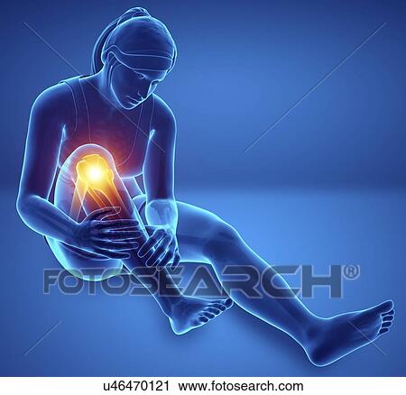 Stock Image - Woman with knee pain, computer illustration.. Fotosearch
