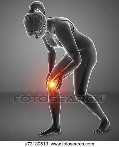 Stock Image - Woman with knee pain, computer illustration.. Fotosearch