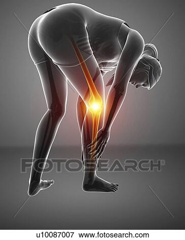 Stock Photo - Woman with knee pain, computer illustration.. Fotosearch