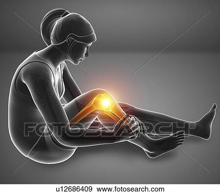 Stock Photo - Woman with knee pain, computer illustration.. Fotosearch