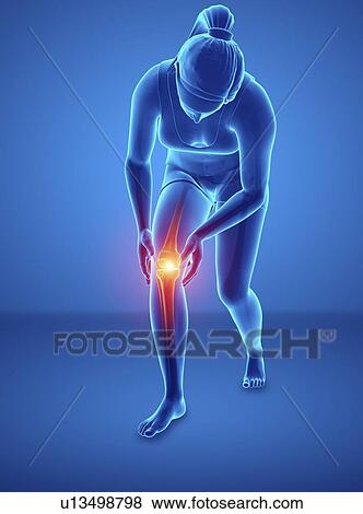 Stock Photo - Woman with knee pain, computer illustration.. Fotosearch