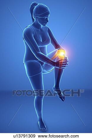 Stock Photo - Woman with knee pain, computer illustration.. Fotosearch