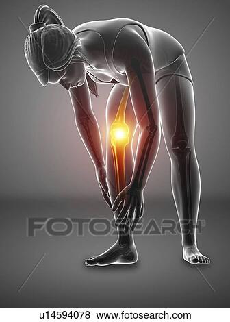 Stock Photo - Woman with knee pain, computer illustration.. Fotosearch