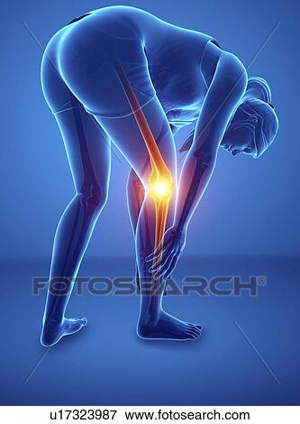 Woman with knee pain, computer illustration. View Large Photo Image Stock Photo - Woman with knee pain, computer illustration.. Fotosearch