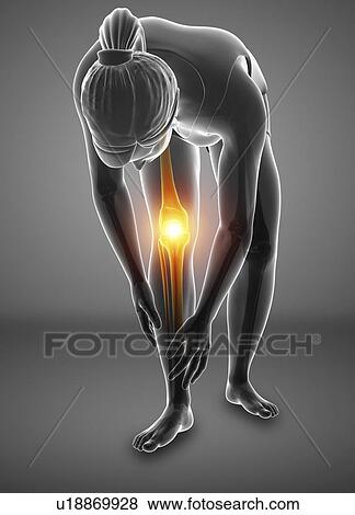 Stock Photo - Woman with knee pain, computer illustration.. Fotosearch