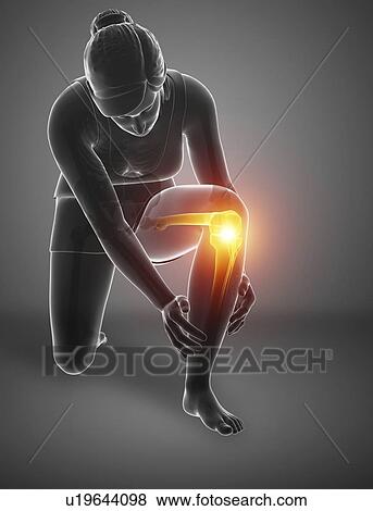 Stock Photo - Woman with knee pain, computer illustration.. Fotosearch