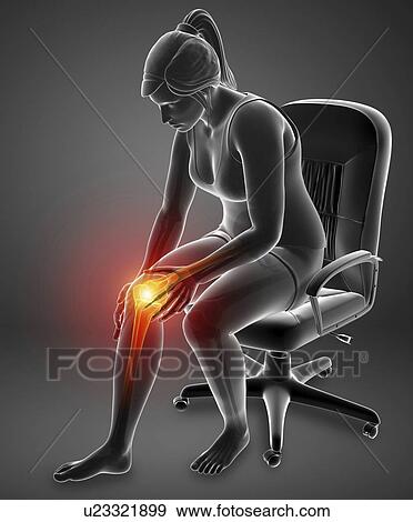 Stock Photo - Woman with knee pain, computer illustration.. Fotosearch