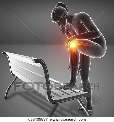Stock Photo - Woman with knee pain, computer illustration.. Fotosearch
