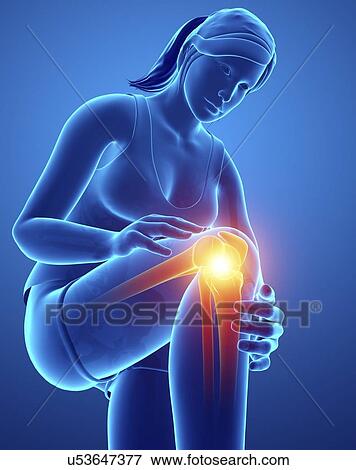 Woman with knee pain, computer illustration. View Large Photo Image Stock Photo - Woman with knee pain, computer illustration.. Fotosearch
