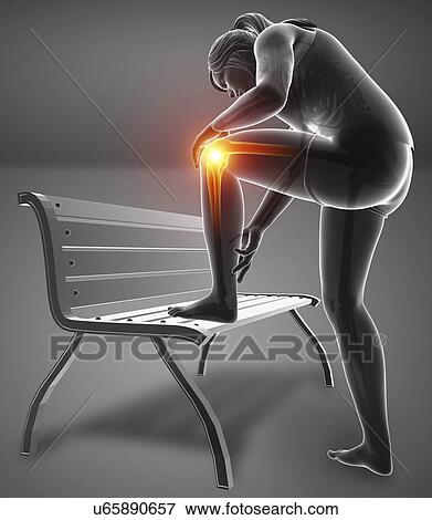 Stock Photo - Woman with knee pain, computer illustration.. Fotosearch