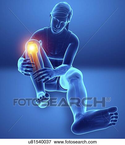 Stock Photo - Woman with knee pain, computer illustration.. Fotosearch