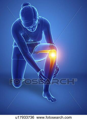 Stock Photograph - Woman with knee pain, computer illustration.. Fotosearch