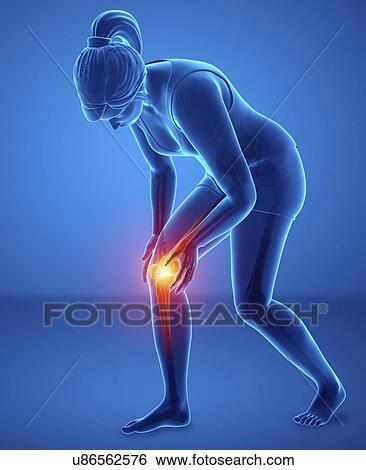 Stock Photograph - Woman with knee pain, computer illustration.. Fotosearch
