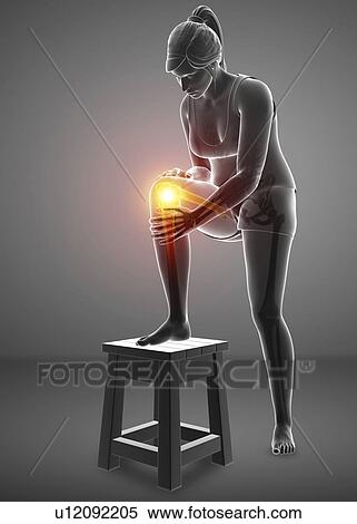 Stock Photography - Woman with knee pain, computer illustration.. Fotosearch