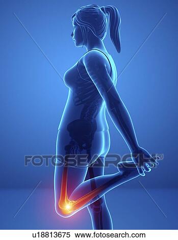 Stock Photography - Woman with knee pain, computer illustration.. Fotosearch