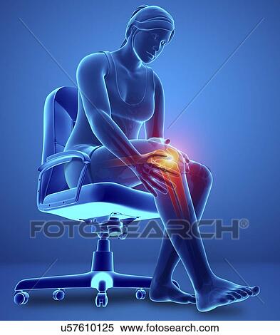 Stock Photography - Woman with knee pain, computer illustration.. Fotosearch