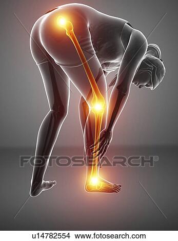 Woman with leg pain, computer illustration. View Large Photo Image Picture - Woman with leg pain, computer illustration.. Fotosearch