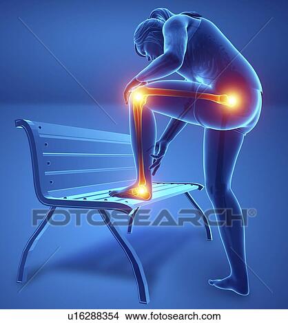 Woman with leg pain, computer illustration. View Large Photo Image Picture - Woman with leg pain, computer illustration.. Fotosearch