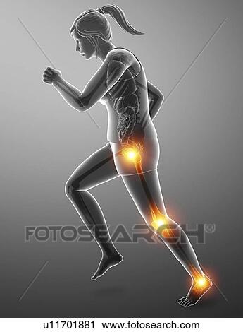 Woman with leg pain, computer illustration. View Large Photo Image Stock Image - Woman with leg pain, computer illustration.. Fotosearch