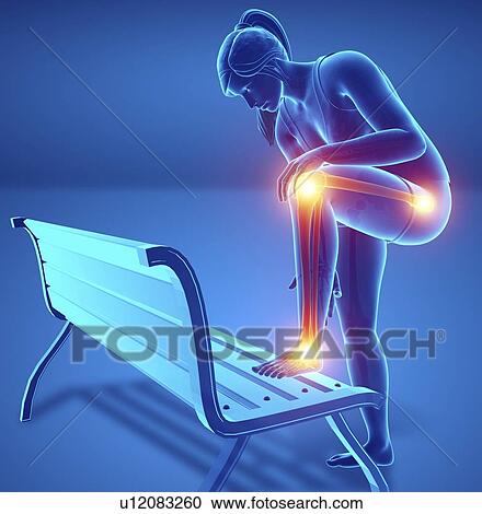 Stock Image - Woman with leg pain, computer illustration.. Fotosearch